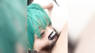 77bandage 모음 지우기전 마지막 (2)